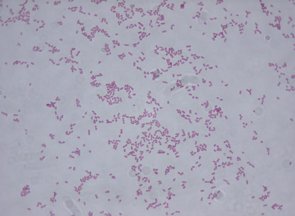 bacteria Klebsiella oxytoca